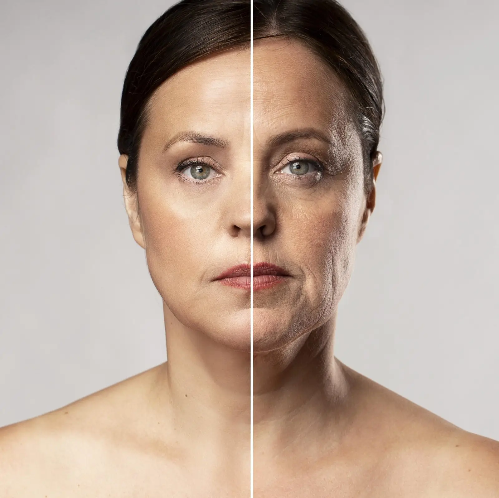 spider face lift before and after