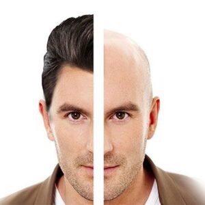 زراعة شعر الجسم في تركيا: 7 حقائق حول التكلفة، ونسبة النجاح