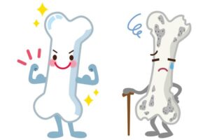 استبدال مفصل الورك في تركيا: 8 معلومات عن العملية، والتكلفة