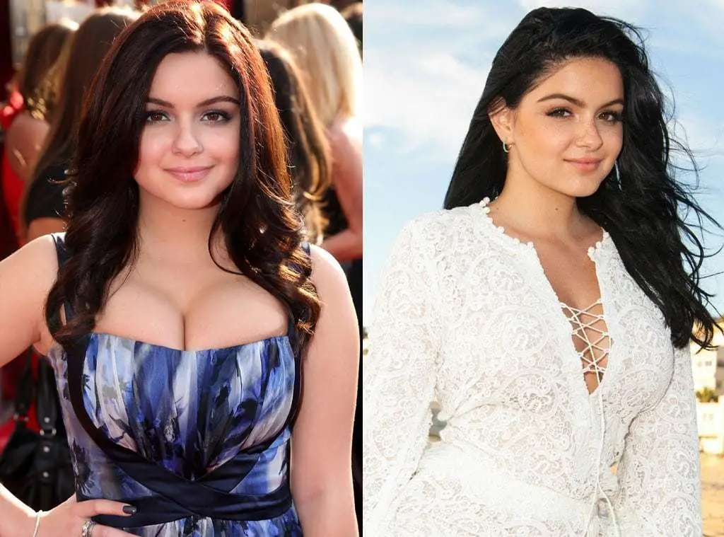 Ariel-Winter-Breast-Reduction