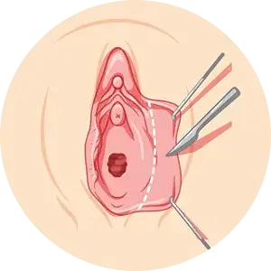 تجميل الشفرات في إسطنبول: 7 فوائد وفترة التعافي 2026