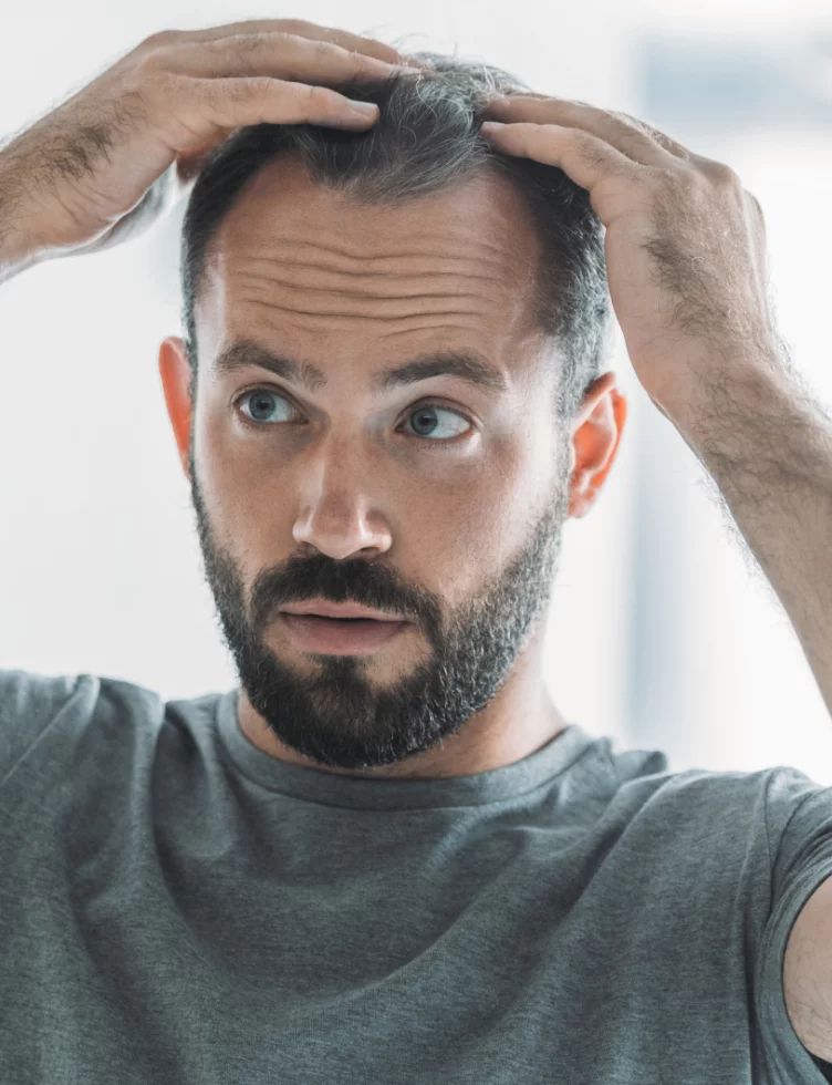 زراعة الشعر: 9 حقائق عن تجارب المشاهير ونتائجها الطبيعية