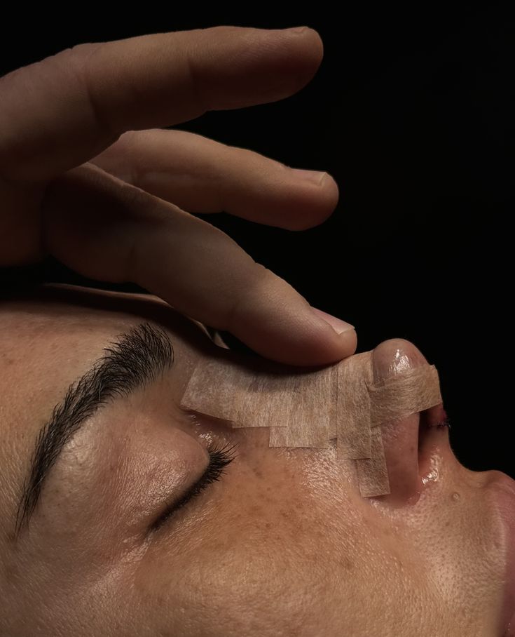 تجميل الأنف في تركيا: 7 اختلافات رئيسية بين الجراحة والفيلر